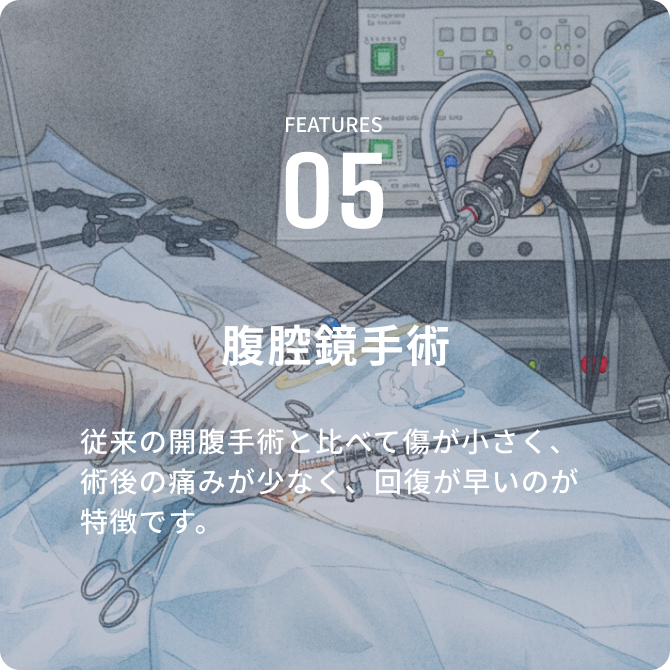腹腔鏡手術