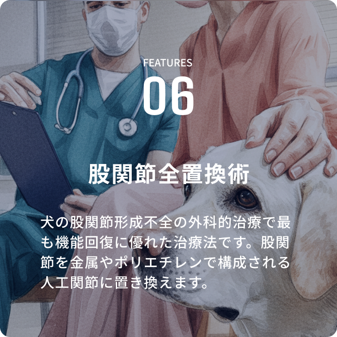 股関節全置換術