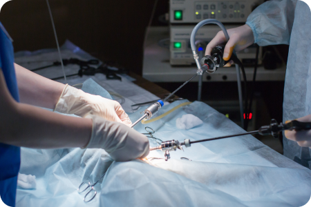 腹腔鏡システム